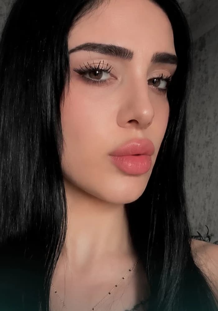 Eyebrow photograph from Capilora’s eyebrow transplant post
